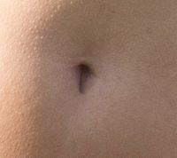 T-shaped navel.jpg